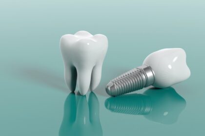 implant vidalı diş